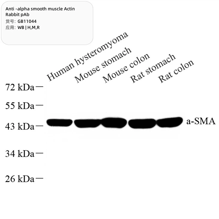 Anti-alpha Smooth Muscle Actin Rabbit PAb