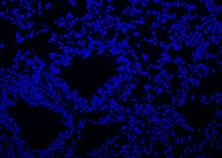 1647940465424209149(001)