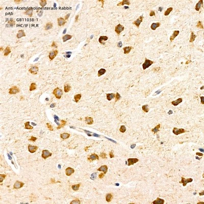 एंटी-एसिटाइलकोलिनेस्टरेज़ खरगोश पब