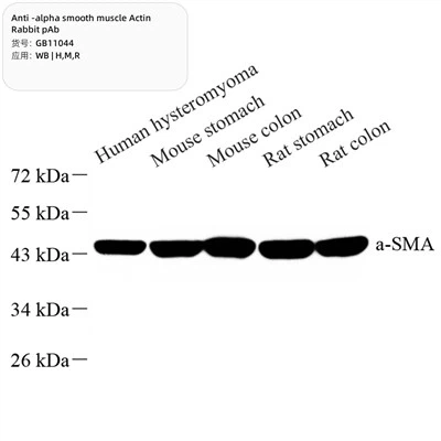 एंटी-अल्फा चिकनी मांसपेशी एक्टिन खरगोश पब