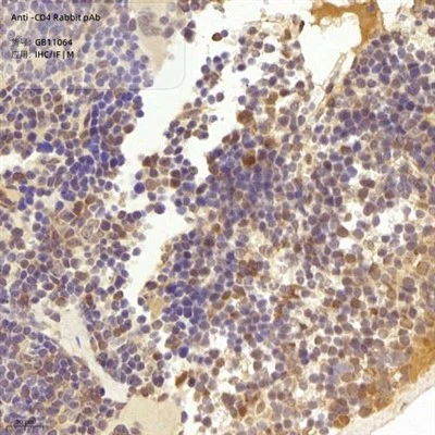 एंटी-सीडी 4 खरगोश पीएबी