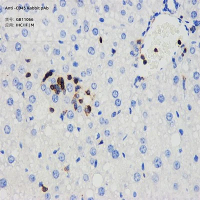 एंटी-सीडी 45 खरगोश पीएबी