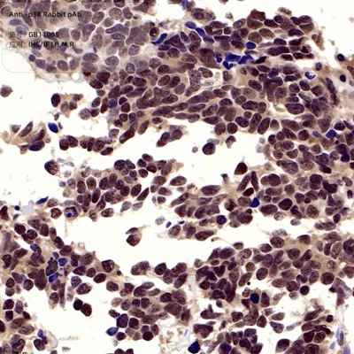 एंटी-पी 38 खरगोश पब