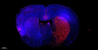 टीएमआर (रेड) ट्यूनल सेल एपोप्टोसिस डिटेक्शन किट